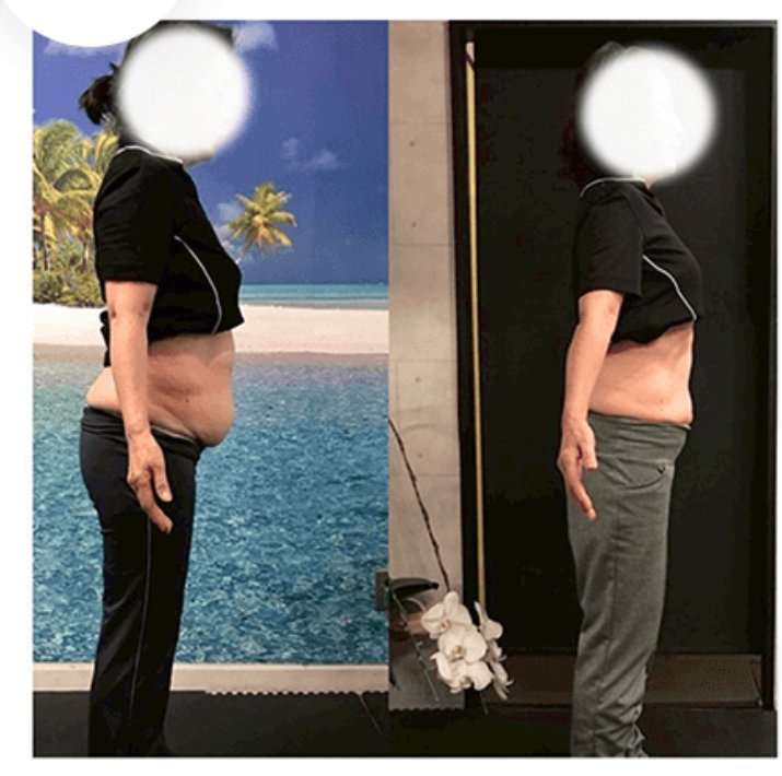 Before / After（3ヶ月で体脂肪率-7%）