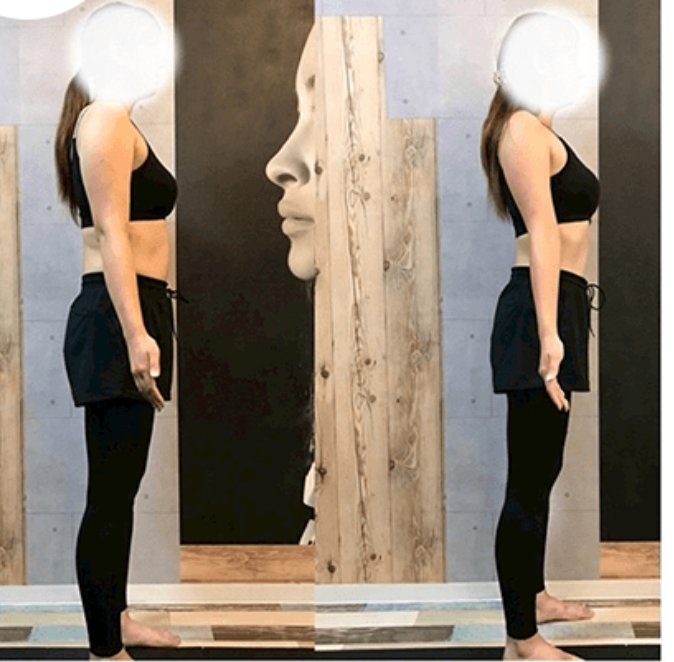 Before / After（3ヶ月で-6kg）